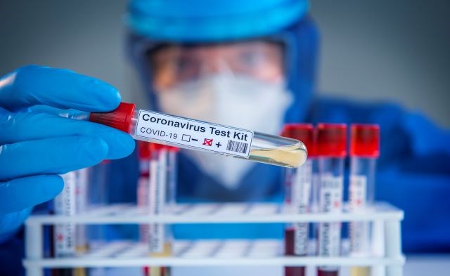 Coronavirus test kit 04292020
