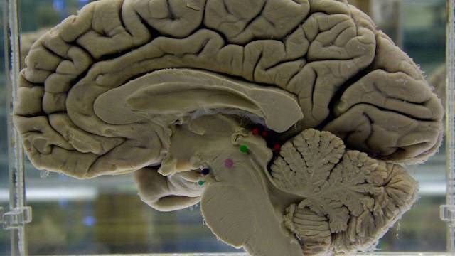 brain