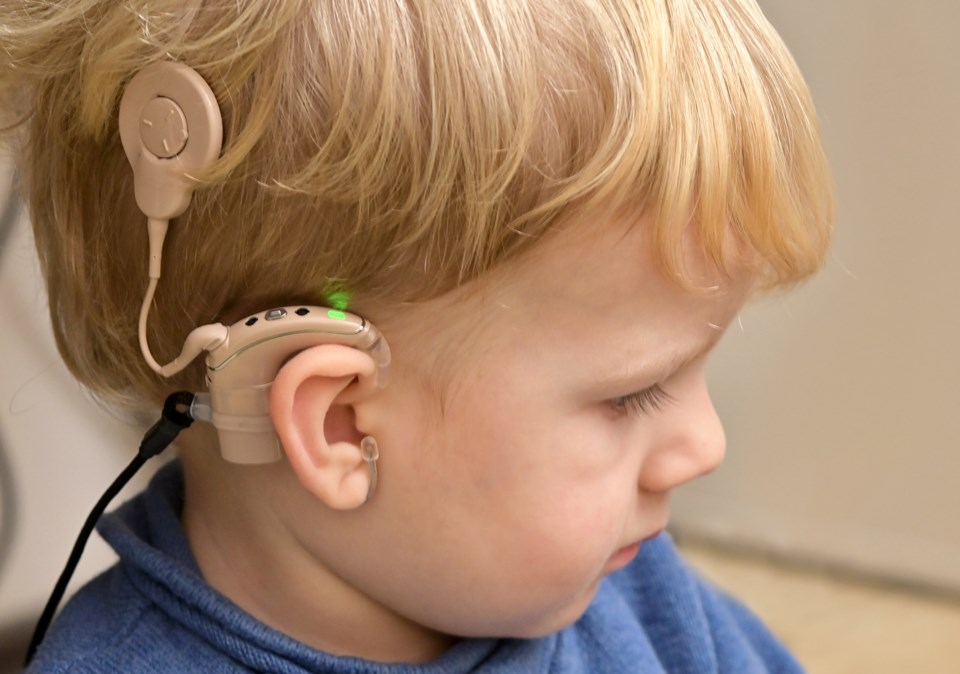 Elks cochlear implant
