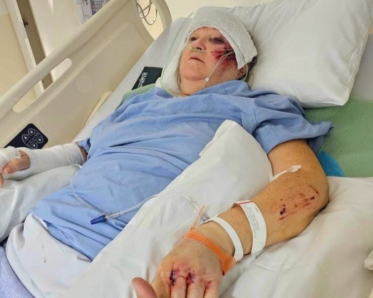 suzanne-blair-hit-and-run