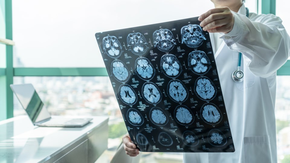 Brain injury diagnosis by doctor using magnetic resonance images (Chinnapong-iStock-Getty Images Plus)