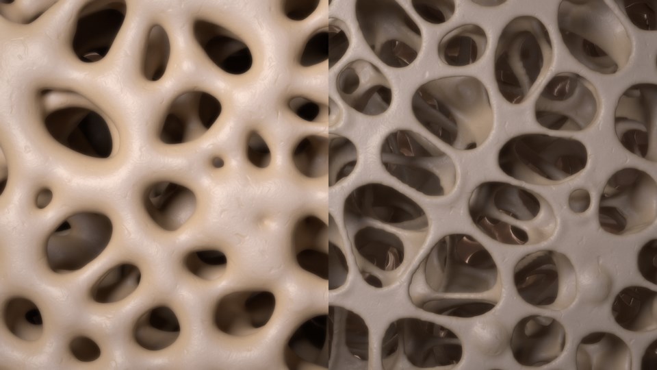 Computer generated image of bone health (Yabusaka Design - iStock - Getty Images Plus)