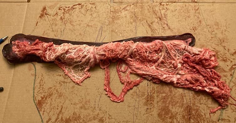 An example of a pig spleen. Photo courtesy Facebook