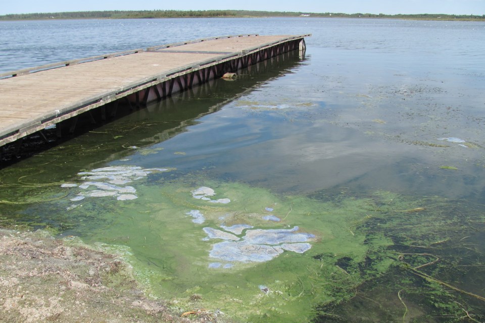 cyanobacteria-blue-green-algae