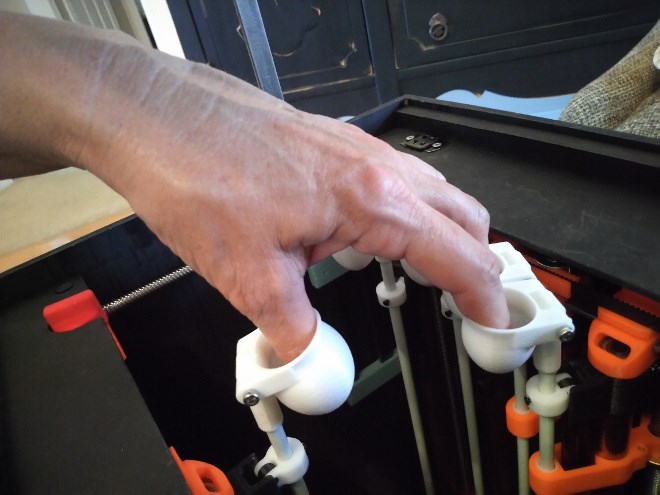 MyHand, created by the Sudbury-based company IRegained, helps patients regain function in their hand after experiencing a stroke. (Supplied photo)