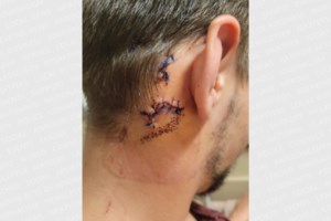 ‘He didn’t deserve this’: Orillia family reeling after violent park assault
