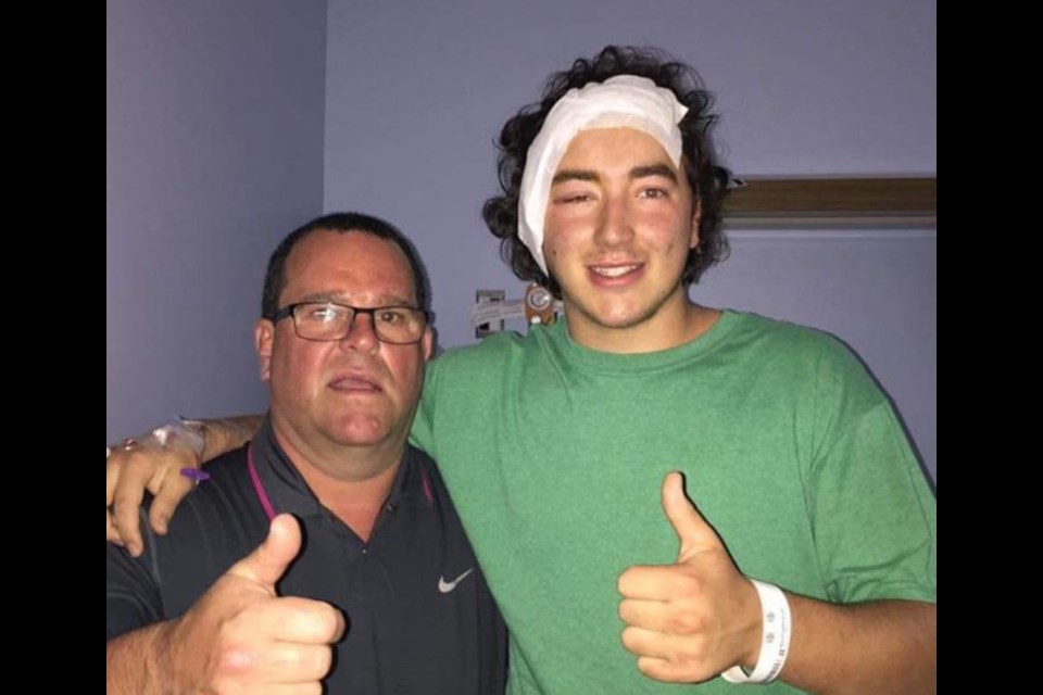 Brandon Douglas, right, is shown with his uncle, Stuart Templeton, a day after Douglas underwent surgery to remove a brain tumour. Supplied photo