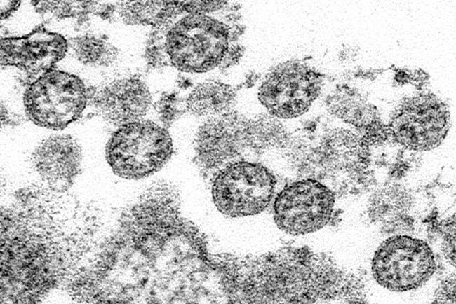covid-19 virus coronavirus
