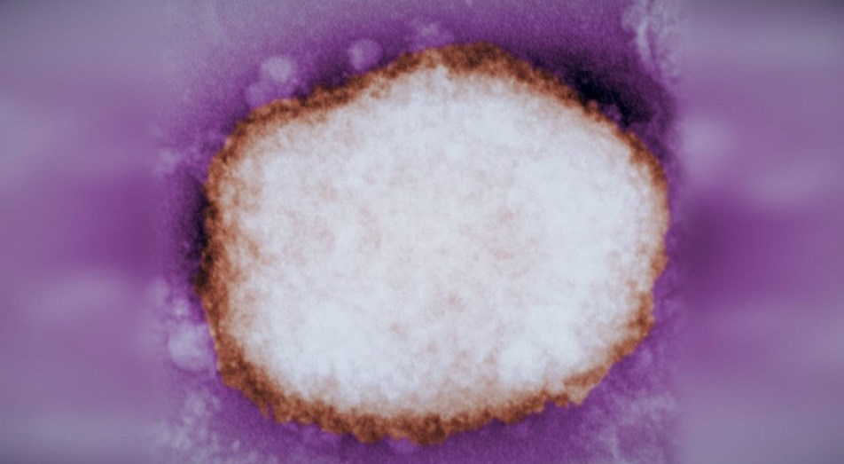 Monkeypox virus quebec