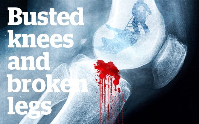 Busted knees and broken legs - Why ACL ski injuries have skyrocketed and what you can do about it. Story by Nicola Jones