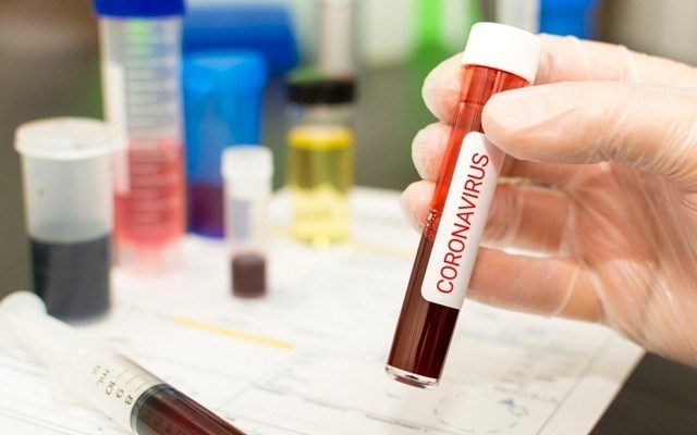 coronavirus