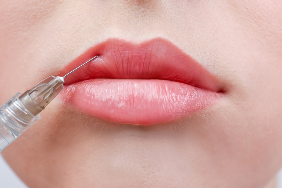 Botox injection lips