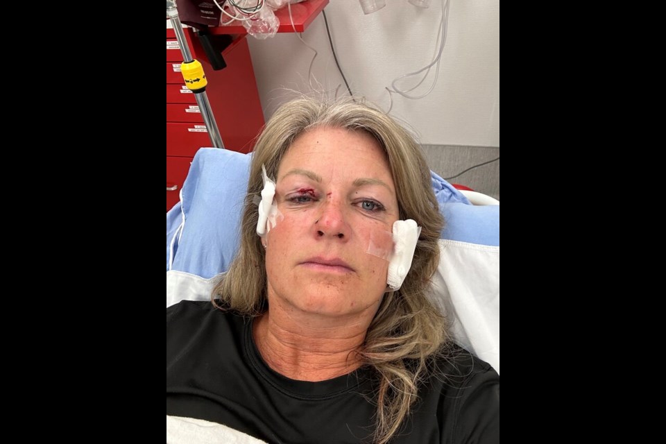 Lisa Robinson was lucky not to lose her eye after a bear attack on Saturday, Sept 16.