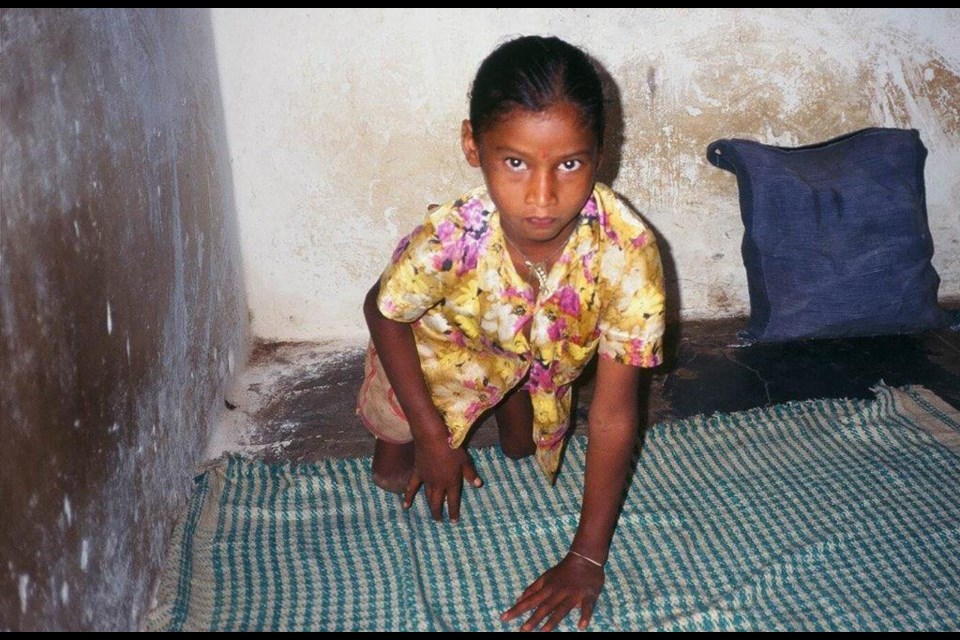 This is Ballavva in 1996. She had severe polio affecting both legs and she was unable to stand. She underwent physical therapy and 
surgery and was provided with braces and crutches by SAMUHA. She was then able to attend school and is now usefully employed in her community health centre.  