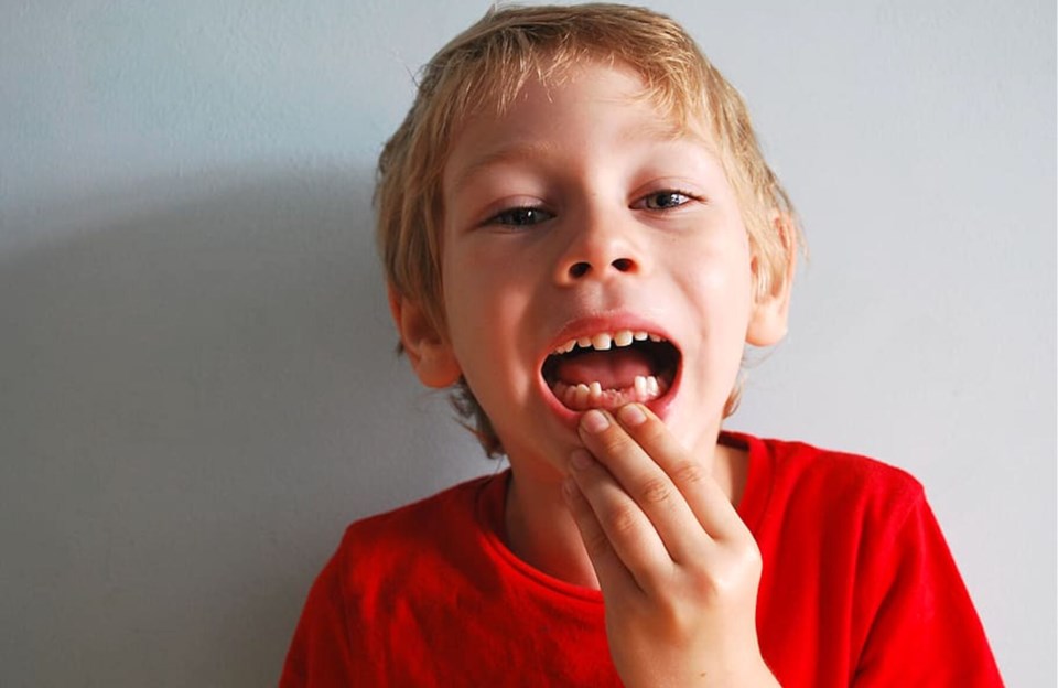 baby-teeth-image