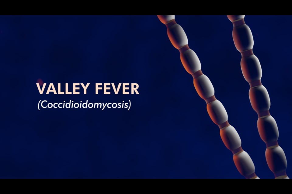 Valley Fever Awareness Week begins today. Taking steps to stay safe from Valley fever (also called coccidioidomycosis) is especially important in Arizona, where the fungus that causes the lung infection grows naturally in the soil. 