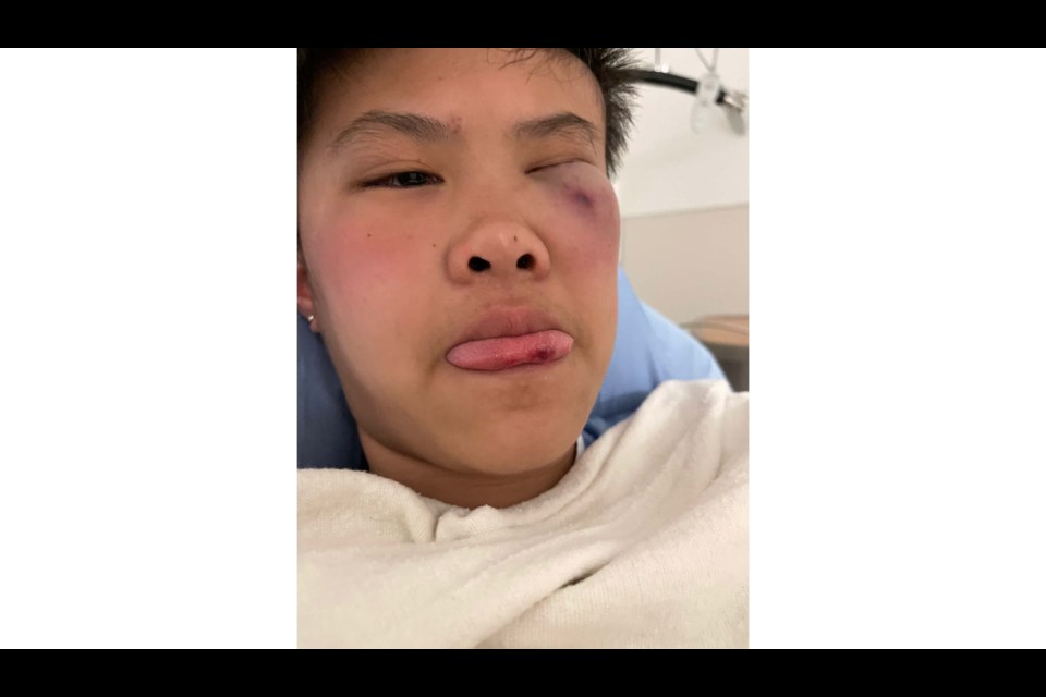 Janice Xie, 14, was badly beaten up by an older male student inside Hugh Boyd Secondary on Thursday, April 21