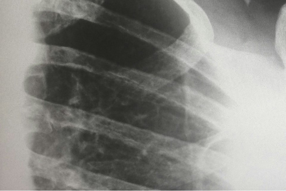xray-unsplash