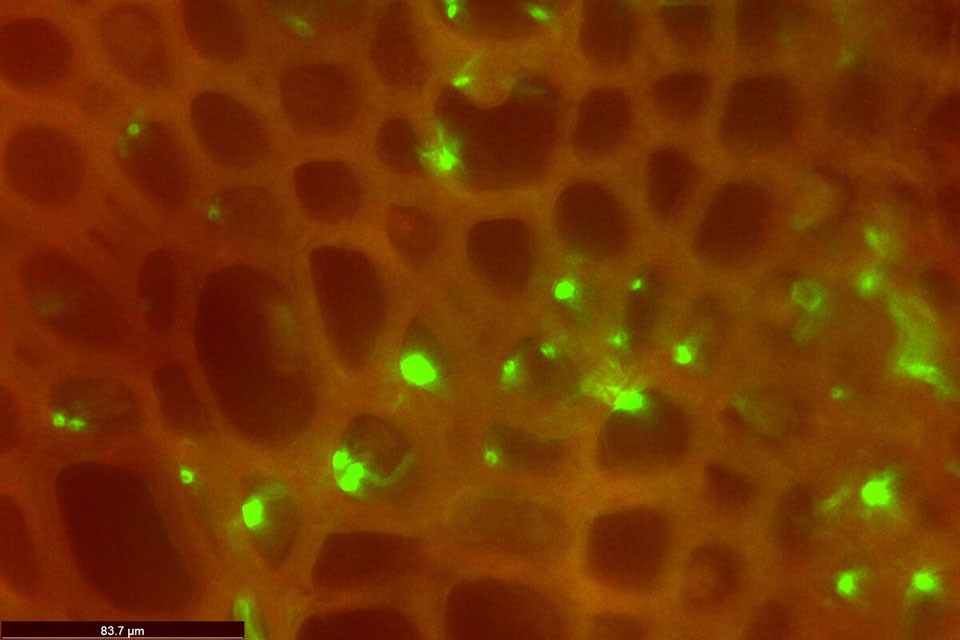 166058_web1_su-flourescent-microscopy-roots-with-verticillium-hyphae-claudio-stasolla