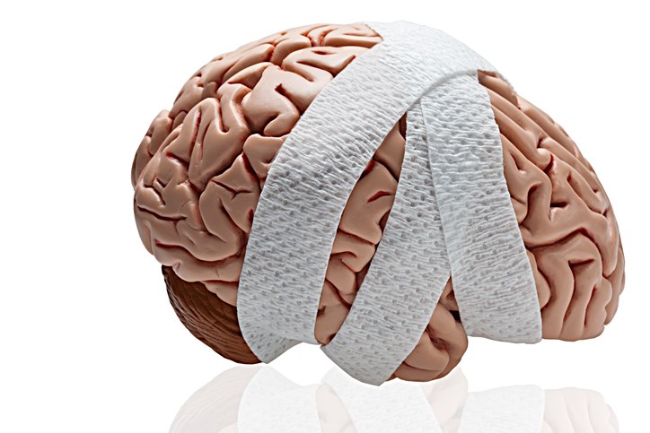 brain injury concussion