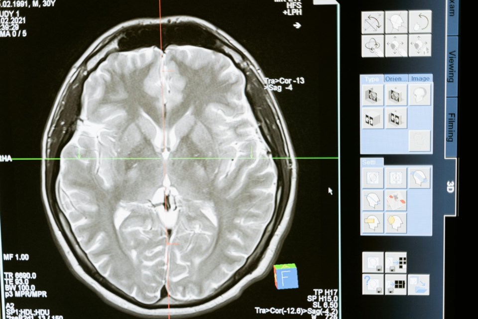 brain-scan-0924