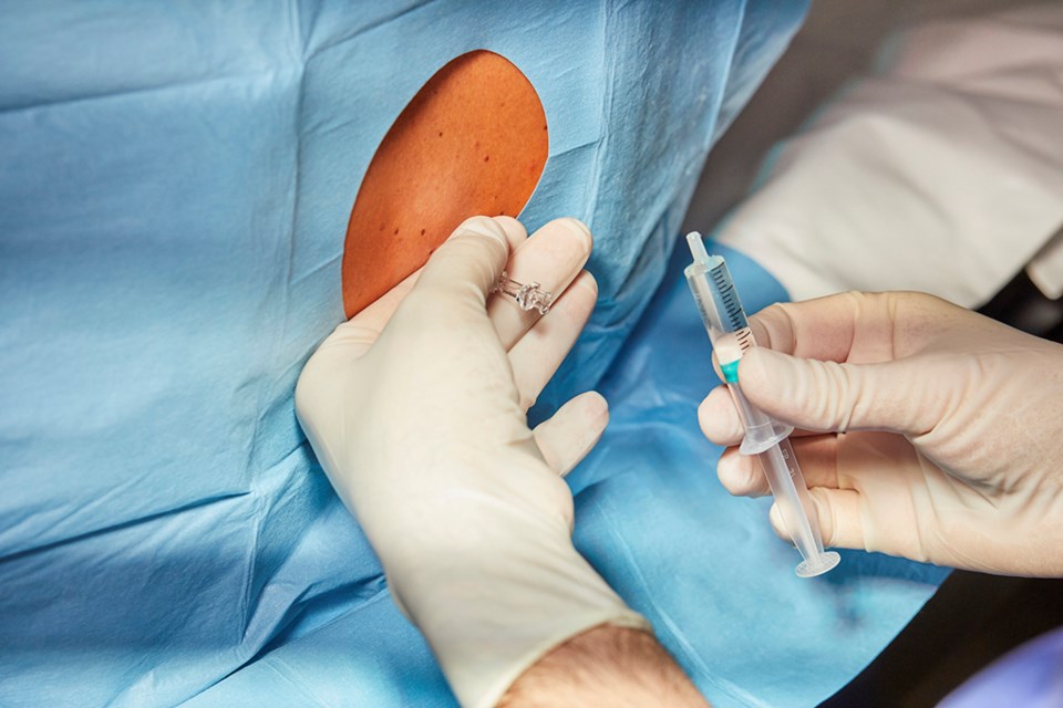 epidural catheter