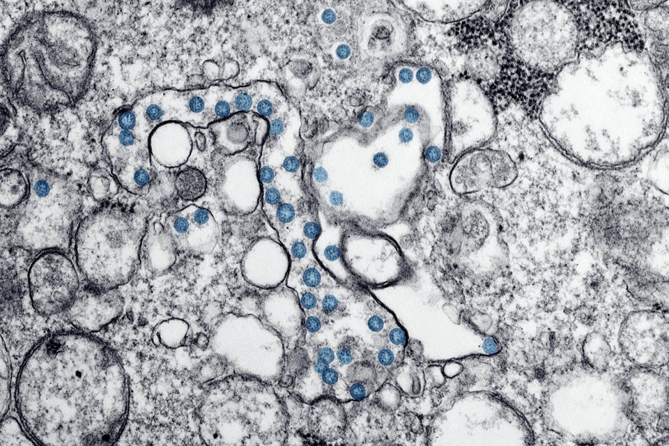 microbes