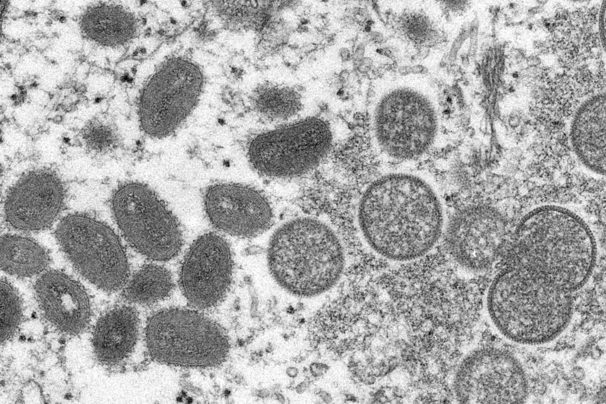 Les régulateurs américains ouvrent la voie à davantage d’expéditions de vaccins contre le monkeypox
