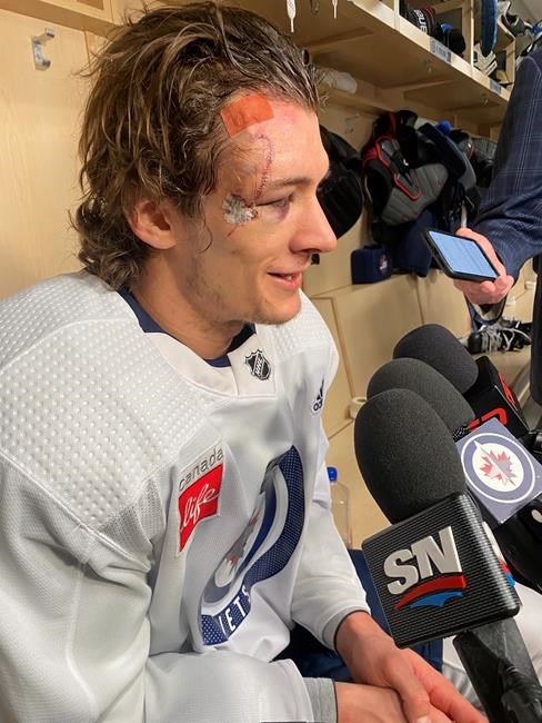 Morgan Barron speaks out on taking skate blade to face in Jets' Game 1 win