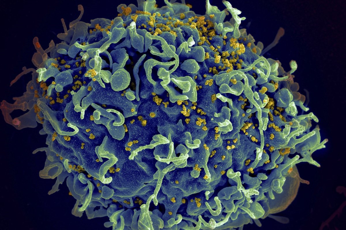 U.S. Funding Cuts Threaten Global HIV/AIDS Progress, Warns UNAIDS