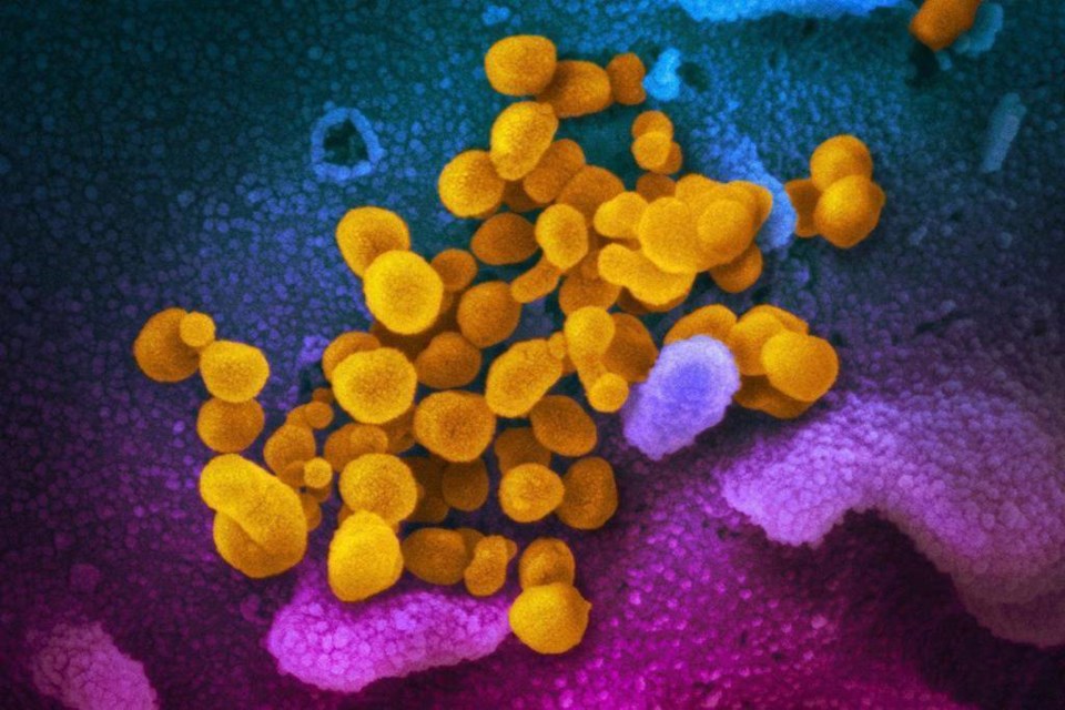 This scanning electron microscope image shows SARS-CoV-2 (yellow)—also known as 2019-nCoV, the virus that causes COVID-19—isolated from a patient in the U.S., emerging from the surface of cells (blue/pink) cultured in the lab.