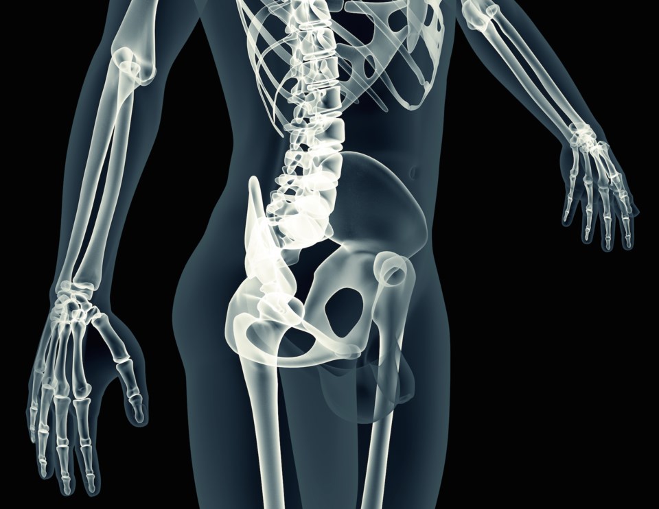 xray body scan skeleton