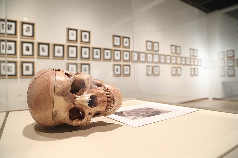A recreation of the skull of Tom Thompson seen on October 1, 2014 at the Art Gallery of Algoma in Sault Ste Marie. Kenneth Armstrong/SooToday