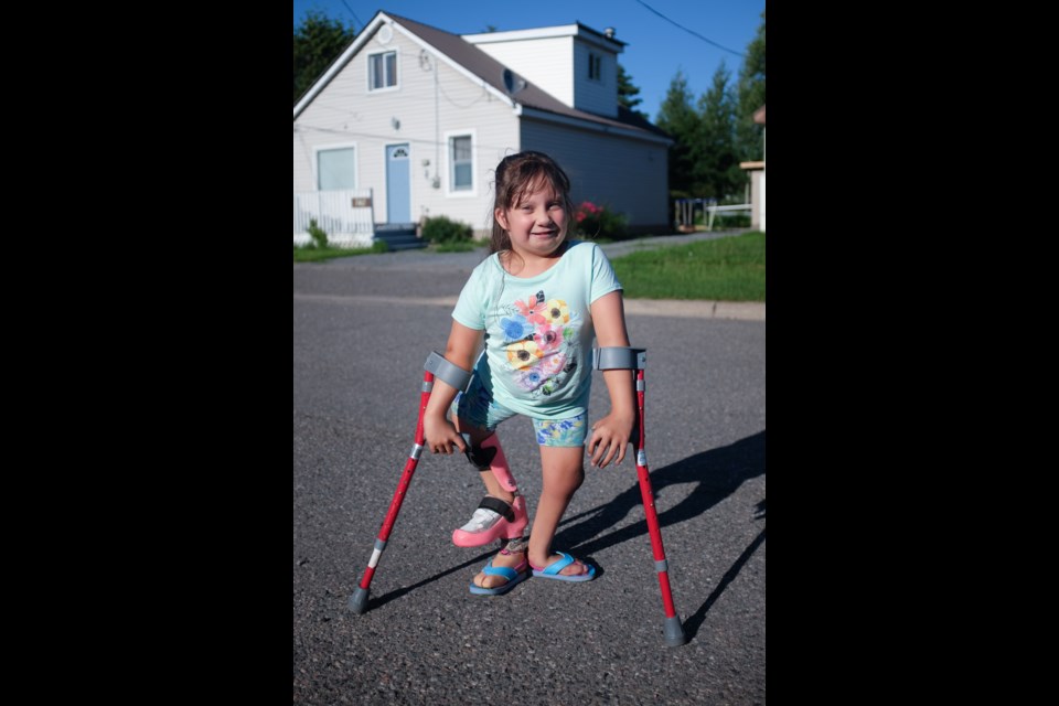 Ciara Pelletier-Lebouef, 7, was born with both Pierre Robin Sequence and the rare birth condition Focal femoral hypoplasia. Photo by Jeff Klassen for SooToday