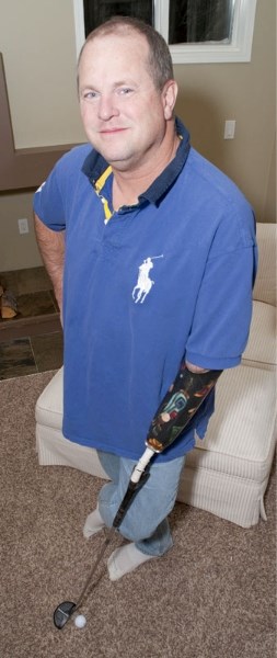 Newspaper owner Grant Bush poses in his home with his prosthetic limb. Bush is one of the many Albertans who live with prosthetic limbs. Born with a deformed arm