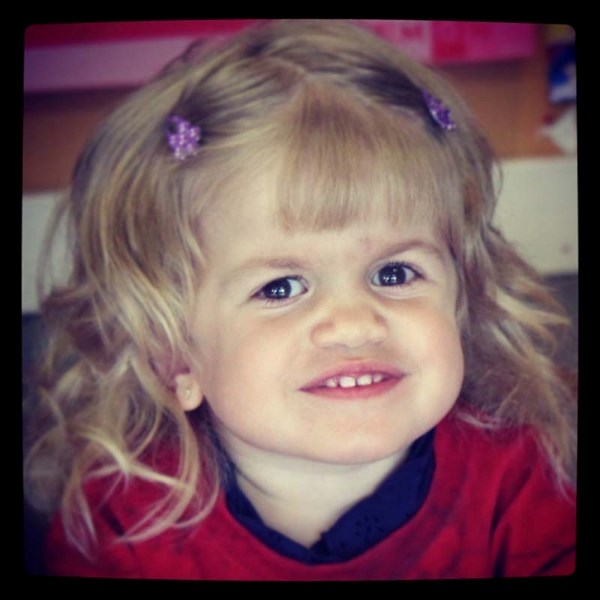 RARE CONDITION – Three-year-old Aleena Sadownyk of St. Albert is battling MPS VI