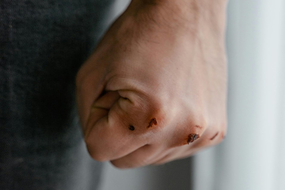 100225_bloody-fist-pexels-mart-production-7699367