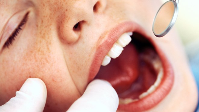 130717_dental_care_child