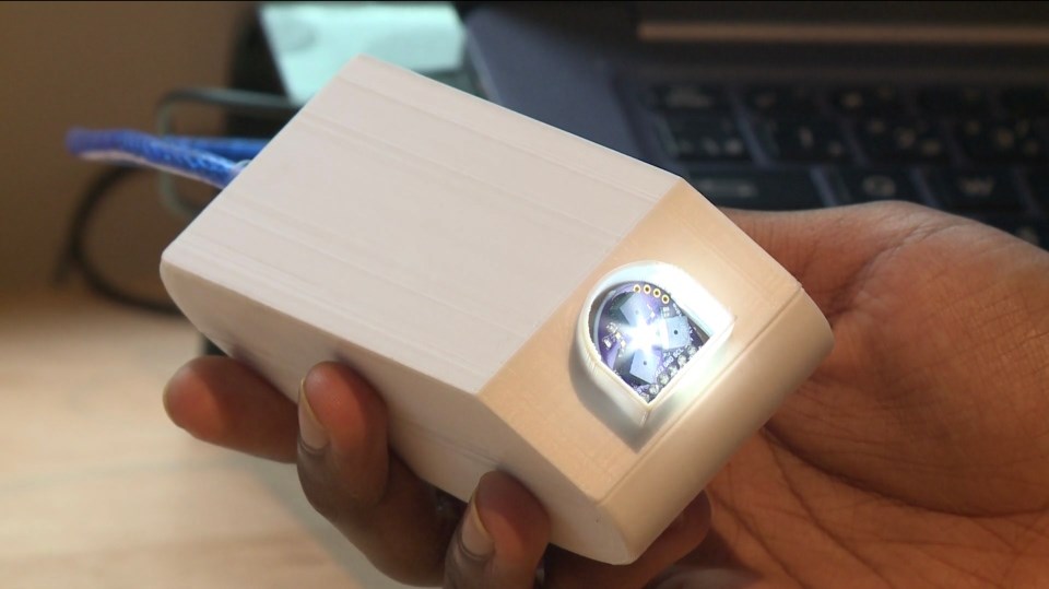 The LIGHT IR cancer detection device. (Photo Supplied)