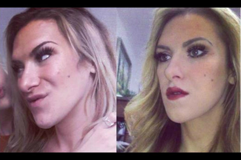 Rebecca Churanova before and after her surgery. (Supplied)