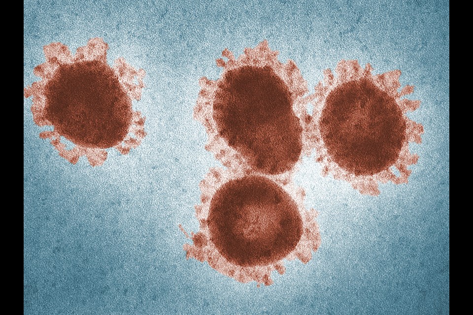 microscopic view of coronavirus covid-19 lab tech test 