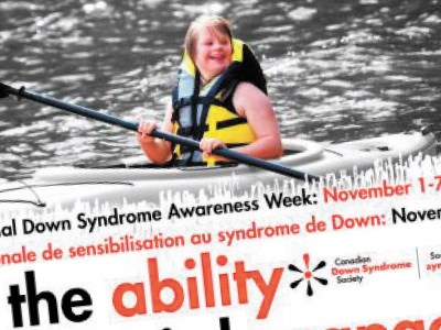 021111_downsyndrome