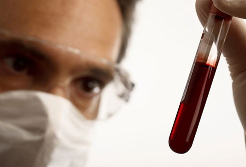 blood test