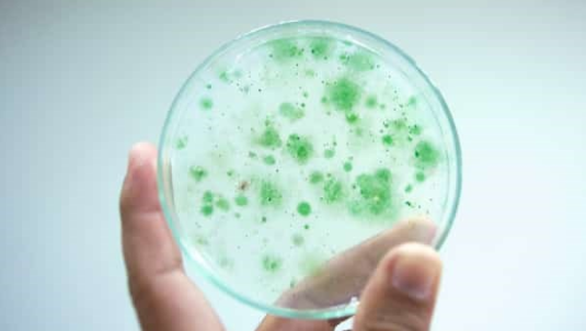 Blue green algae bacteria