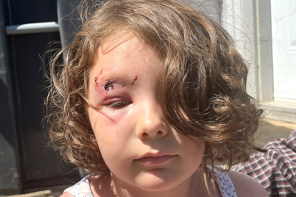 Six-year-old Willow Royer was attacked by a dog on the evening of Tuesday, Aug. 6, 2024 outside of her Wiley Street home. The owner of the dog allegedly involved can been seen on video calmly walking away. (Leith Dunick, tbnewswatch.com)