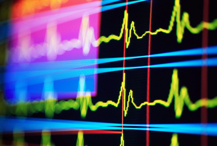 heart rate monitor stock photo by Randy Faris Getty Images