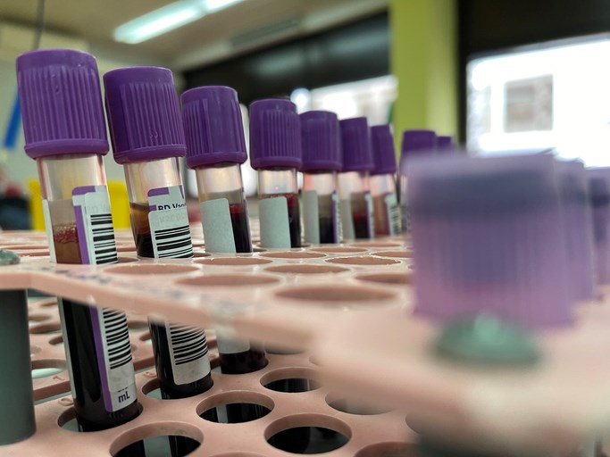 laboratory-blood-test-vials-by-jasmin-merdan-getty-images