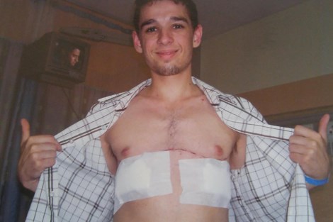 Patrick Lessard has undergone two double lung transplants. Lessard is pictured in hospital after his first transplant in 2006.