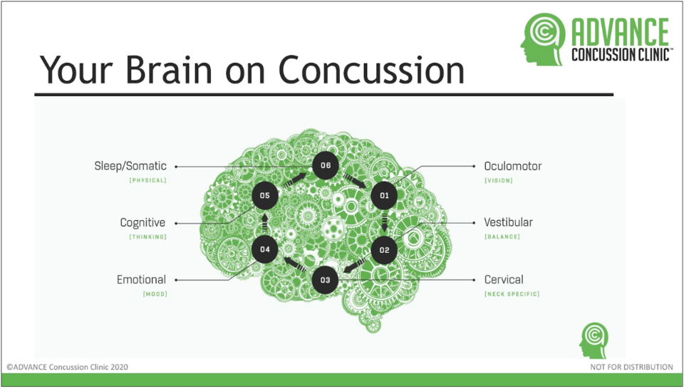 Brain on Concussion