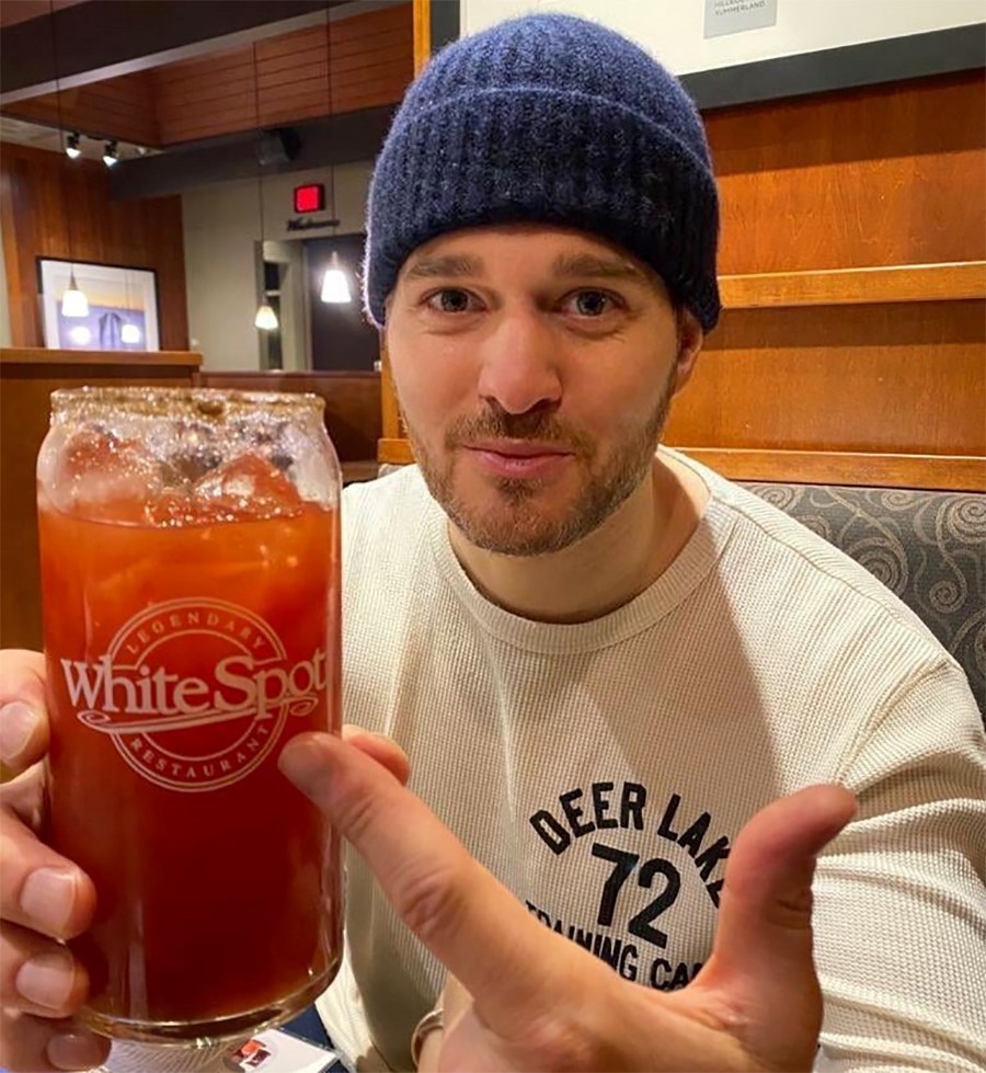 michael-buble-white-spot